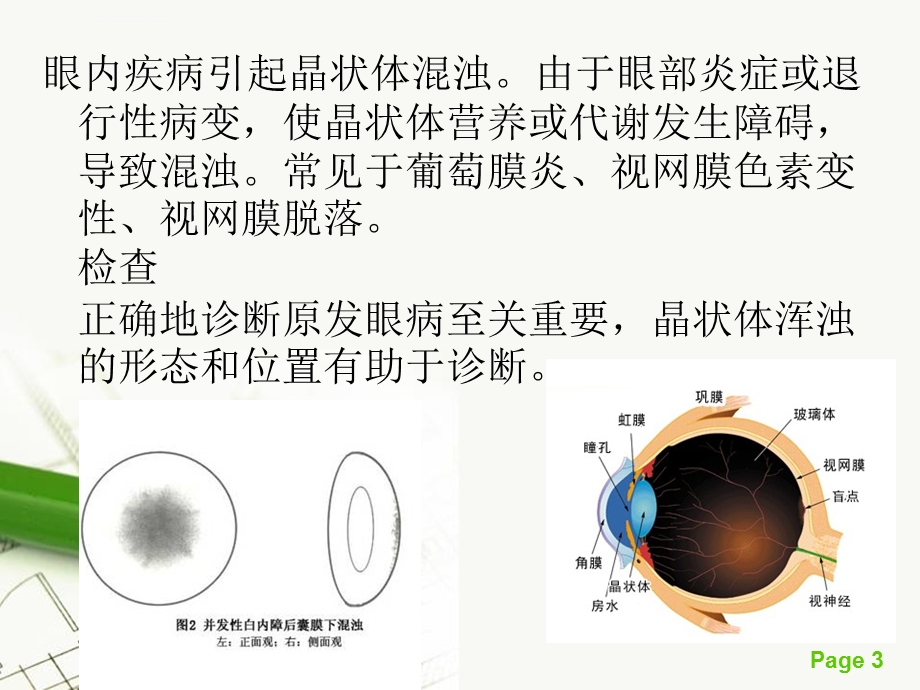 并发性白内障ppt课件.ppt_第3页