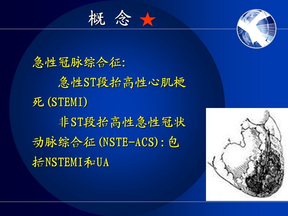 急性冠脉综合征规范化治疗课件医学.ppt_第2页