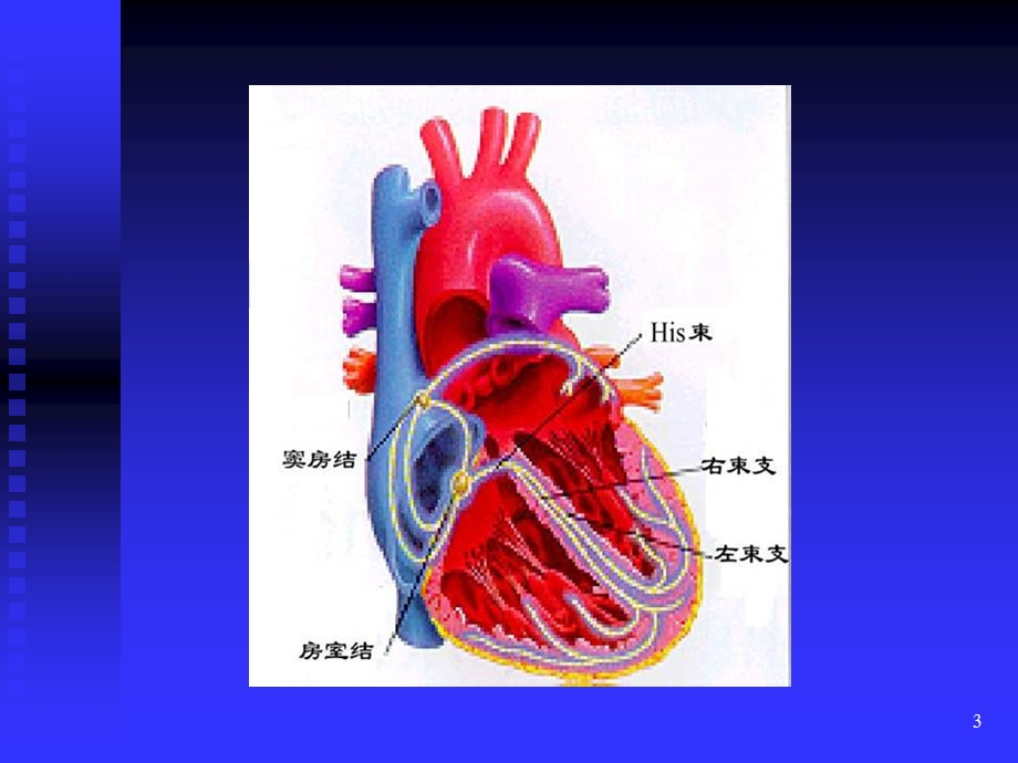 心律失常心电图(转)ppt课件.ppt_第3页