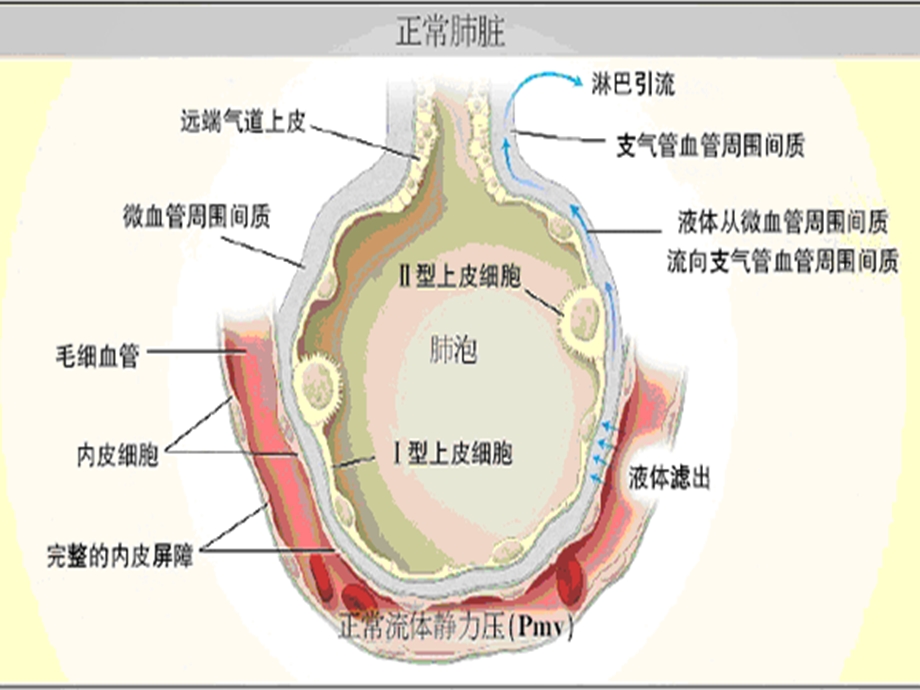 急性肺水肿知识讲座课件.ppt_第2页