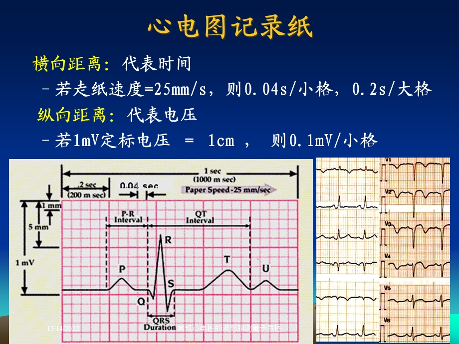 常规心电图的波形和测量示意图课件.ppt_第3页