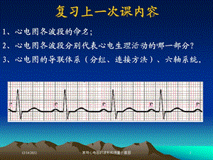 常规心电图的波形和测量示意图课件.ppt