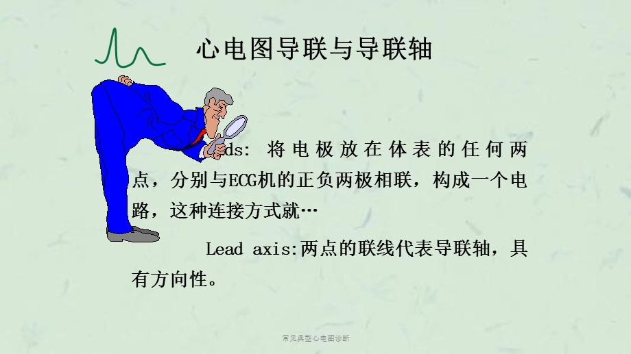 常见典型心电图诊断课件.ppt_第2页