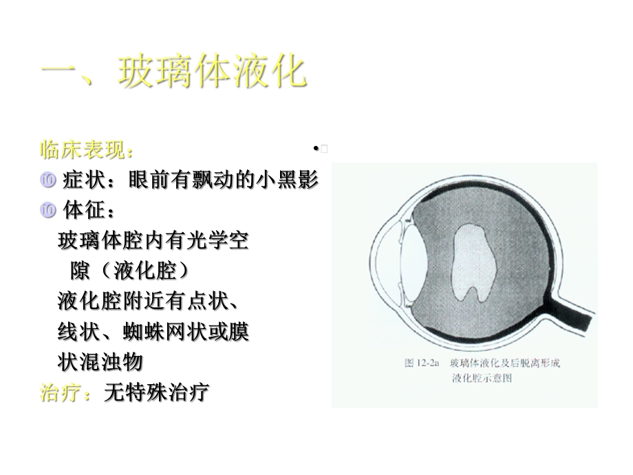 玻璃体疾病课件医学.ppt_第3页