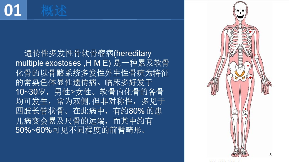 尺骨远端遗传性多发性骨软骨瘤病课件.ppt_第3页