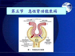 急性肾功能衰竭病人护理课件.ppt