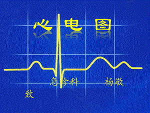 常见心电图心电图ppt课件.pptx