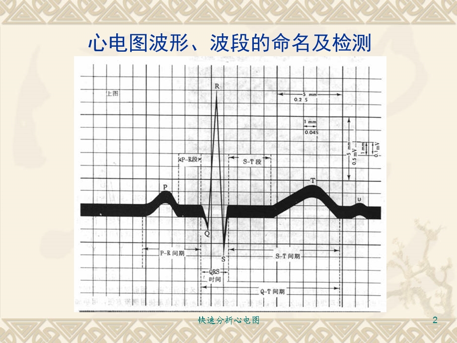 快速分析心电图培训课件.ppt_第2页