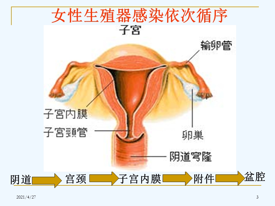 宫颈炎附件炎盆腔炎课件.ppt_第3页