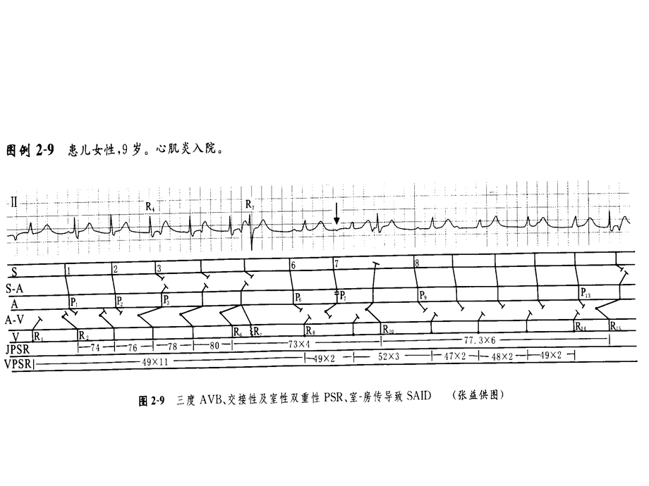 大学课件心电图图谱.ppt_第2页