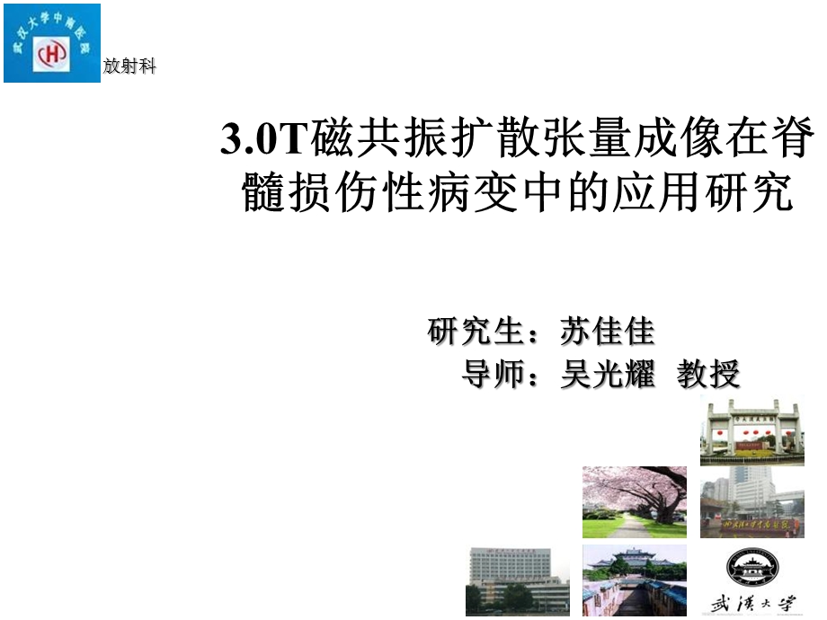 扩散张量成像在脊髓损伤中的应用医学课件.ppt_第1页