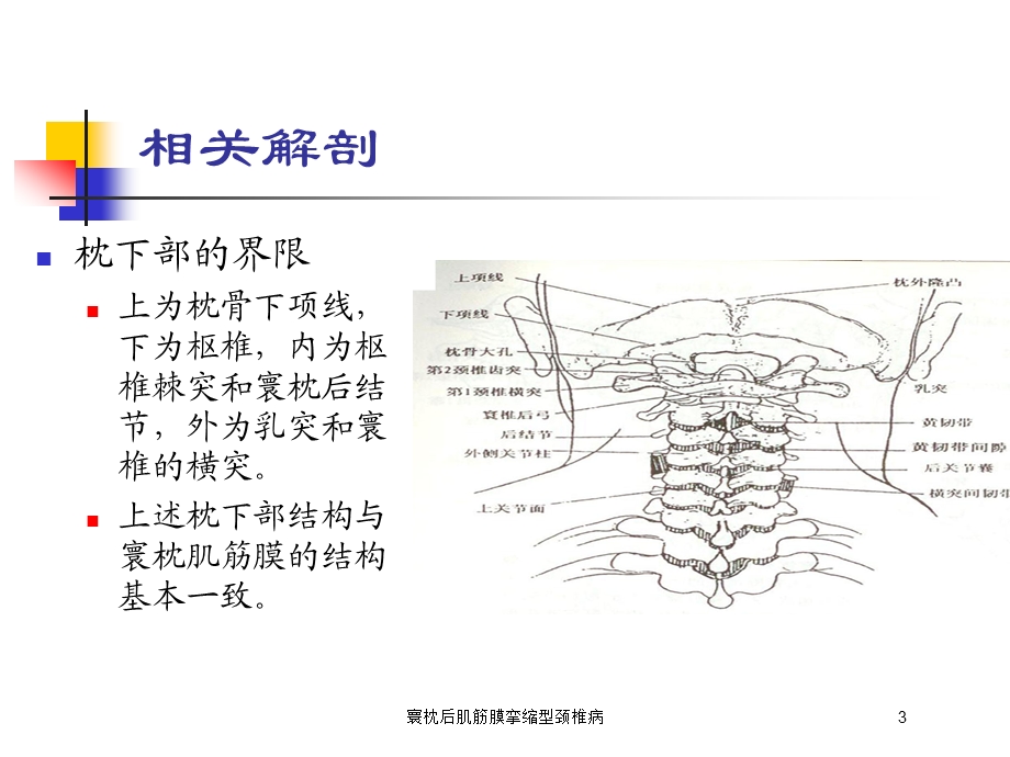 寰枕后肌筋膜挛缩型颈椎病培训课件.ppt_第3页