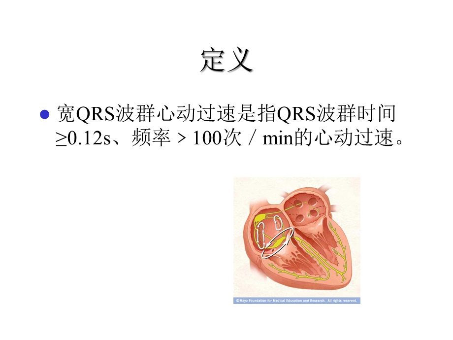 宽QRS波心动过速的临床鉴别经典课件.ppt_第2页