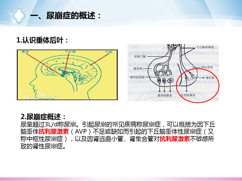 尿崩症护理查房ppt课件.pptx_第3页