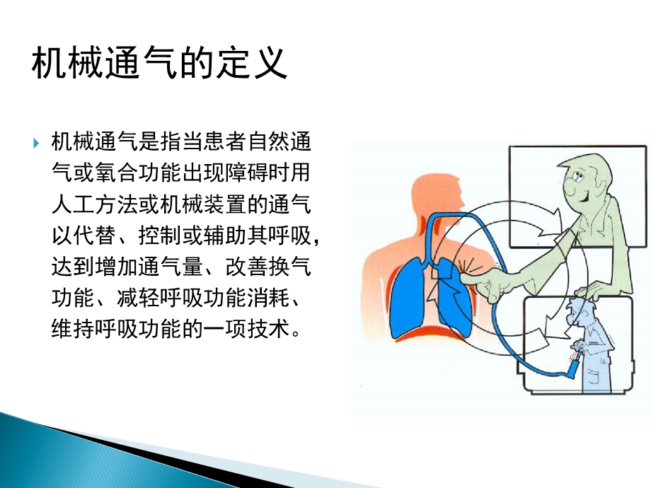 机械通气的护理要点ppt课件.pptx_第2页