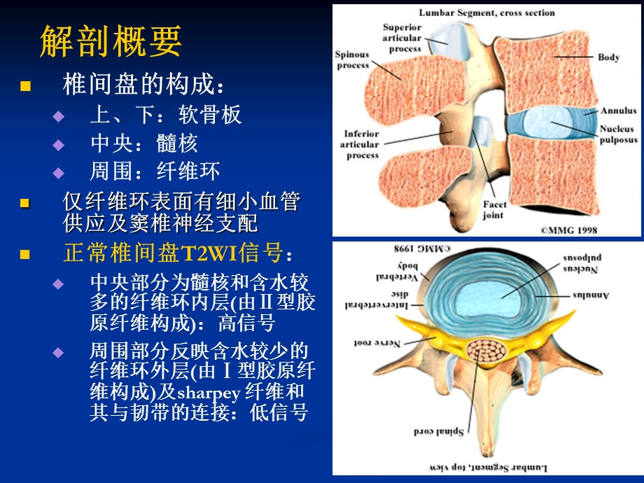 椎间盘突出影像诊断分析ppt课件.ppt_第2页