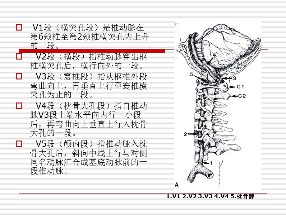 椎动脉分段ppt课件.ppt_第3页