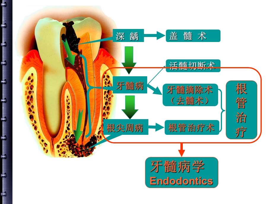 根管治疗的步骤、方法、器械ppt课件.ppt_第2页