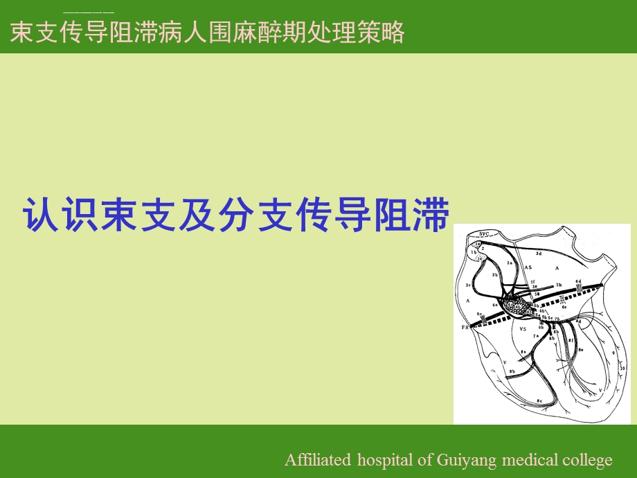 束支传导阻滞病人围术期管理策略ppt课件.ppt_第3页