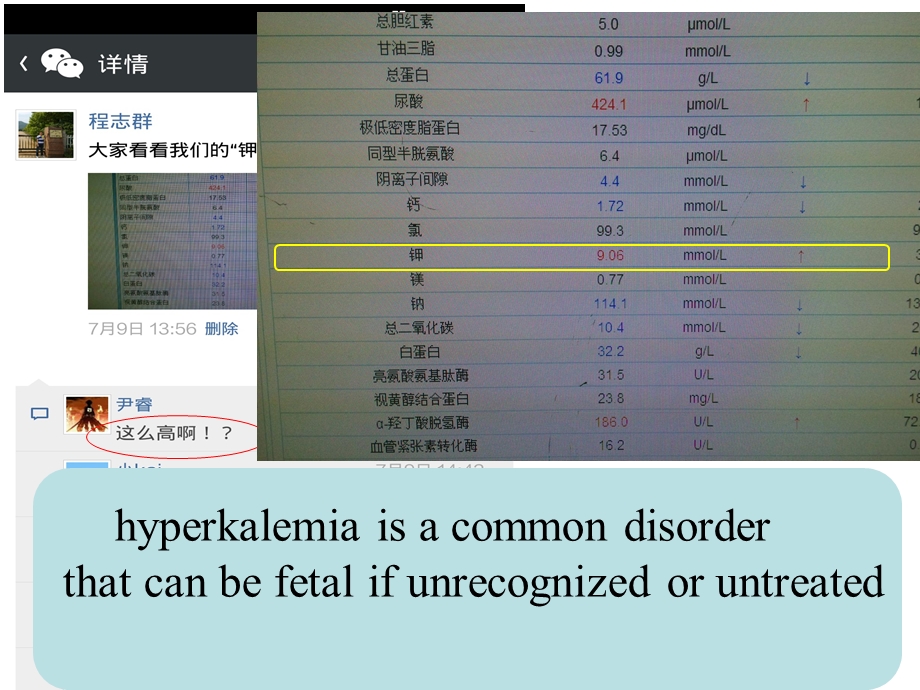 最详细高钾血症(中心医院肾内科)ppt课件.ppt_第2页