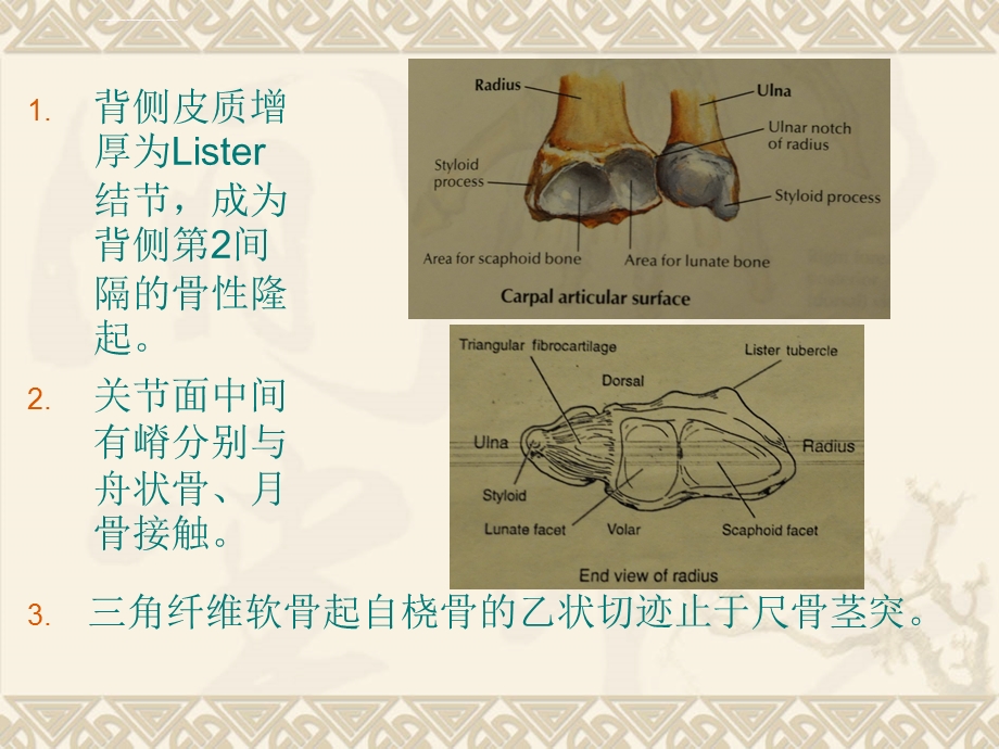 桡骨远端关节内骨折ppt课件.ppt_第3页