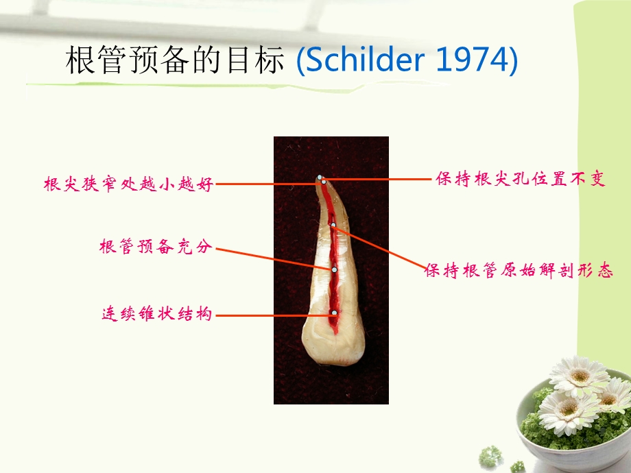 根管预备器械及方法总结ppt课件.ppt_第3页