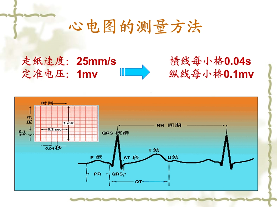 正常心电图及常见异常心电图ppt课件.ppt_第2页