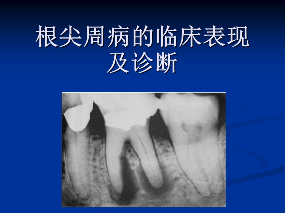 根尖周病的临床表现及诊断ppt课件.ppt_第1页