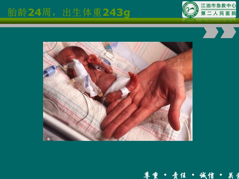 新生儿分类及特点概述ppt课件.ppt_第3页