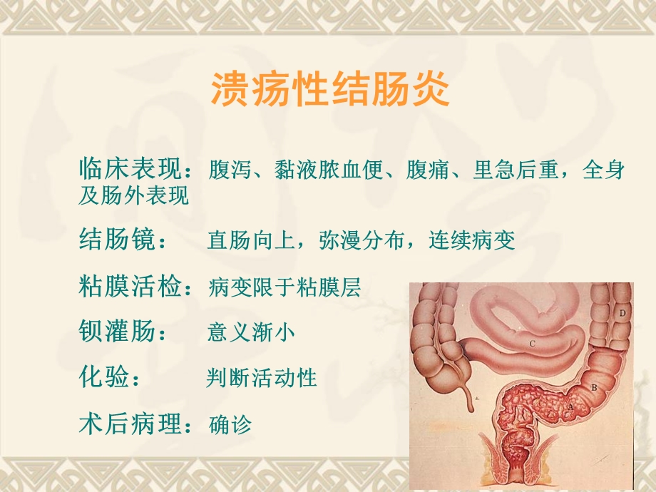 溃疡性结肠炎诊治指南ppt课件.ppt_第3页