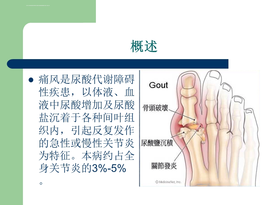 痛风结节的影像表现ppt课件.ppt_第2页