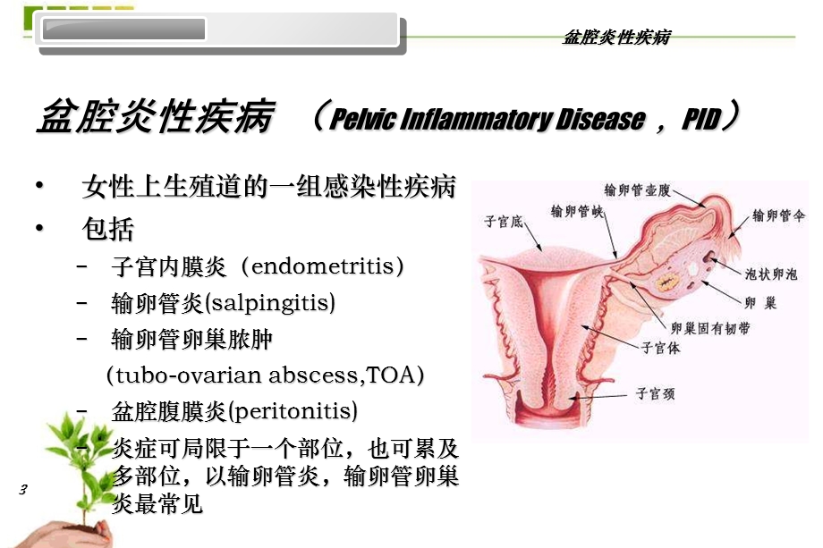 盆腔炎ppt课件.ppt_第3页