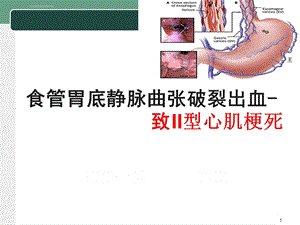 病例汇报ppt课件.ppt