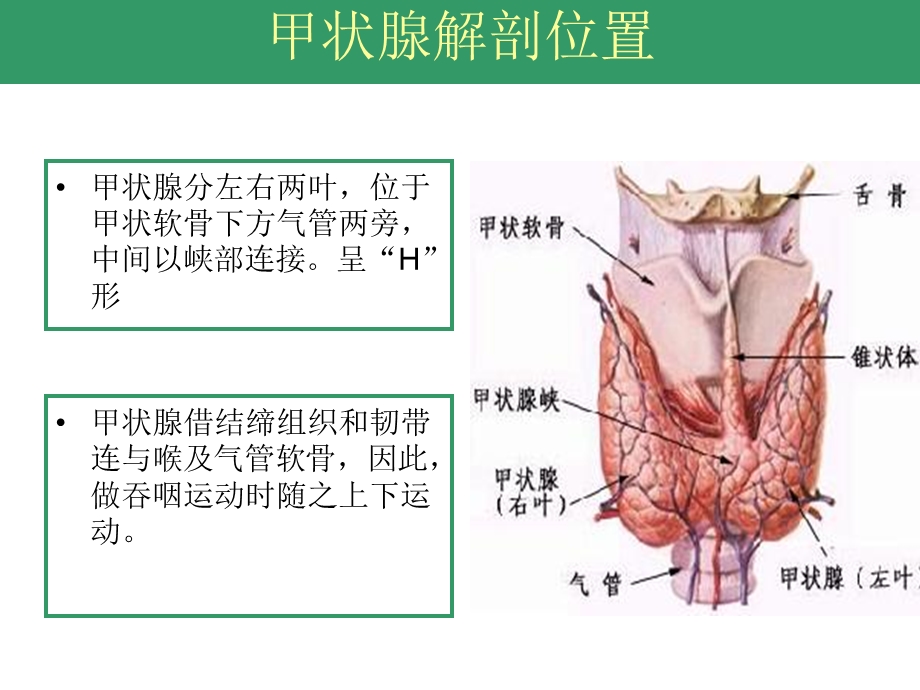 甲状腺手术配合ppt课件.ppt_第3页