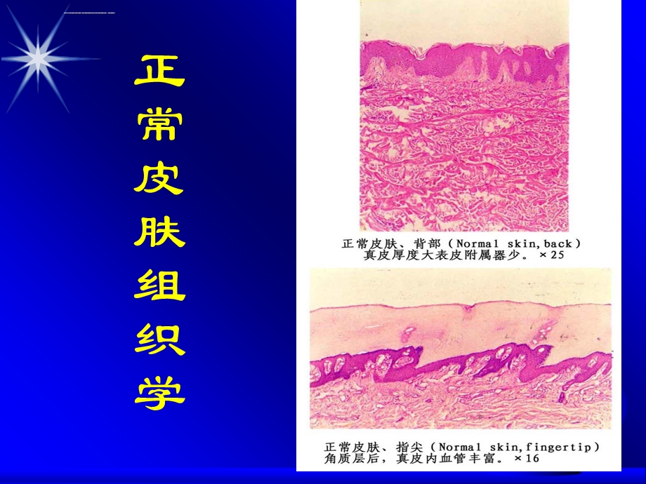 皮肤移植植皮术ppt课件.ppt_第3页