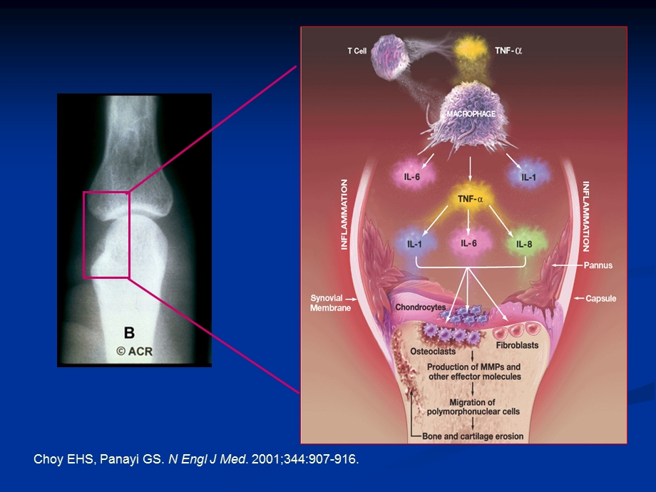 生物制剂在风湿病中的应用ppt课件.ppt_第3页