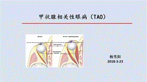 甲状腺相关性眼病ppt课件.pptx