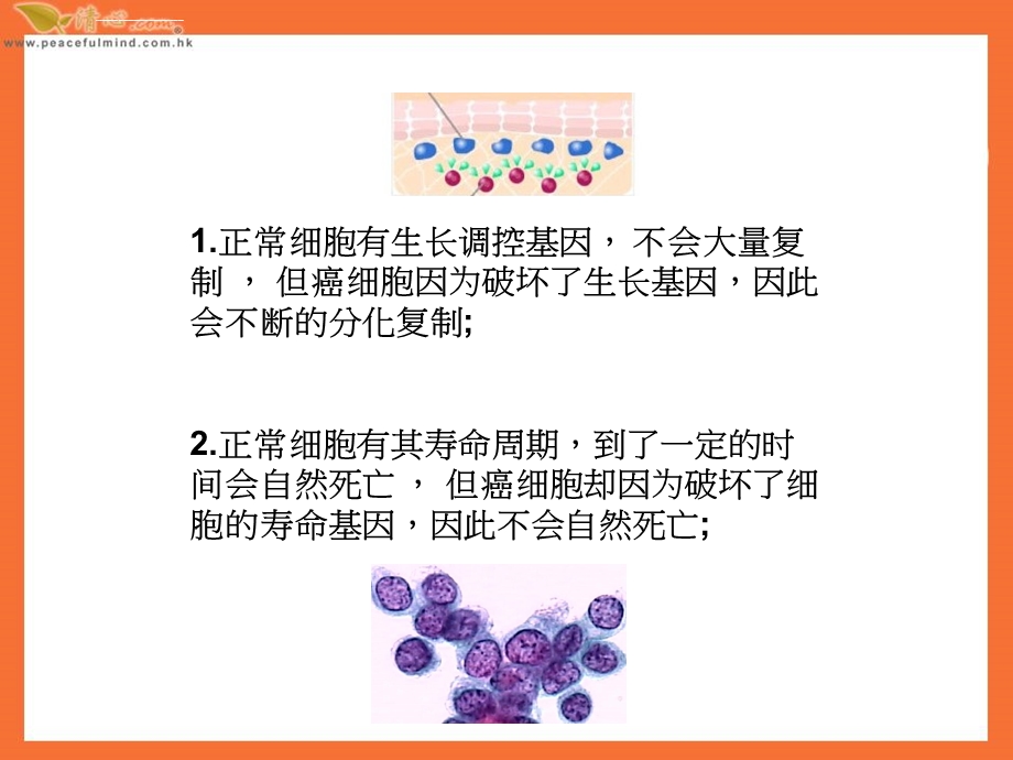 癌细胞与正常细胞最大的不同ppt课件.ppt_第2页