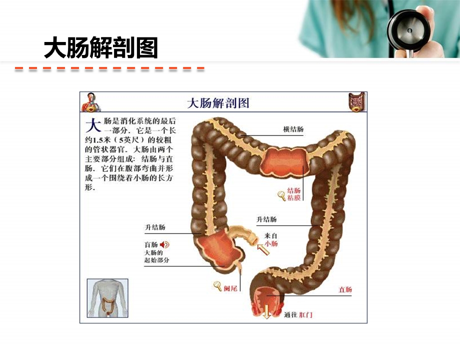 直肠癌护理查房ppt课件.pptx_第3页