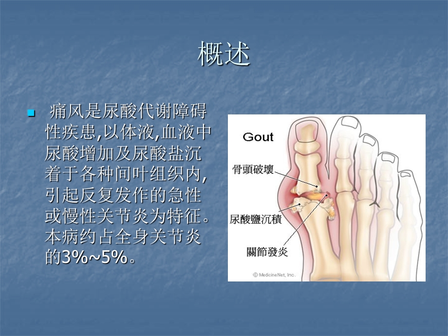 痛风性关节炎ppt课件.ppt_第2页