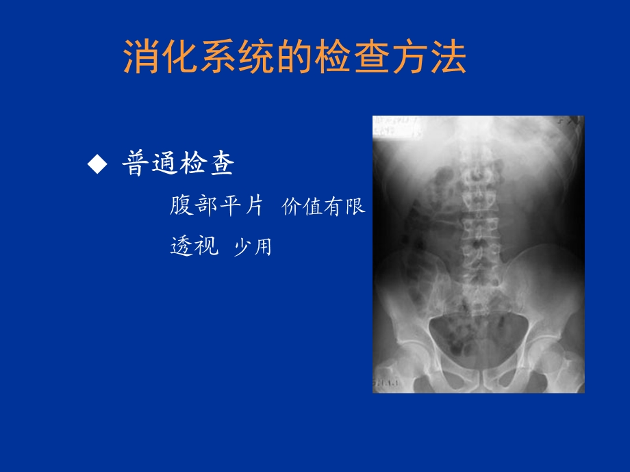 消化系统影像学ppt课件.ppt_第2页