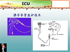 漂浮导管测力值及意义ppt课件.ppt