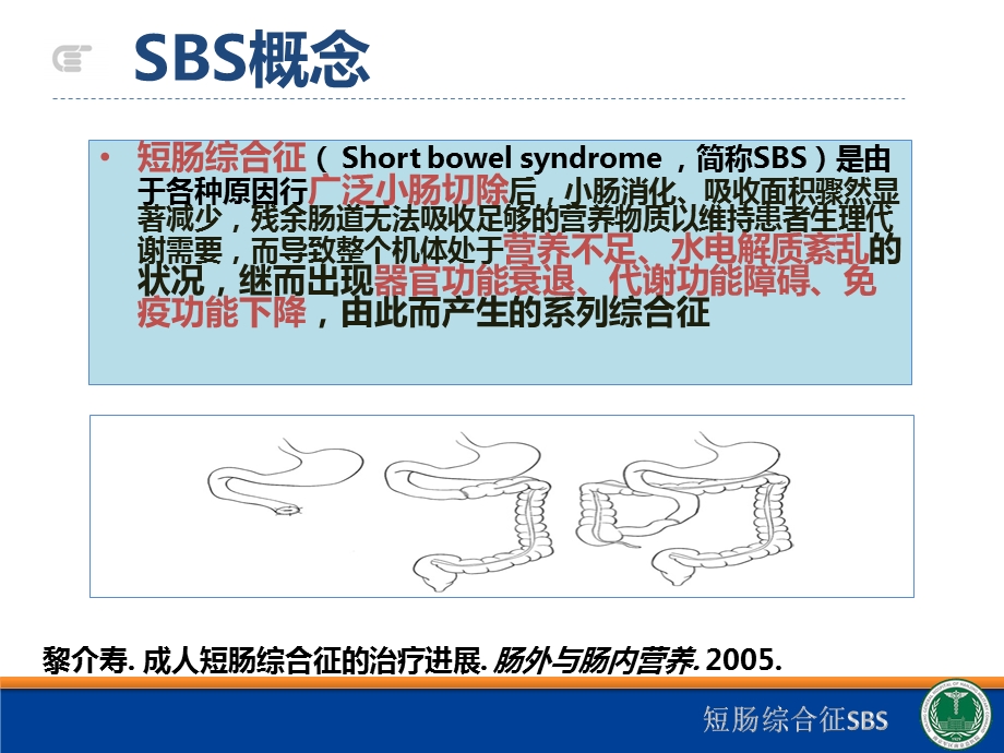 短肠综合征SBSppt课件.pptx_第2页