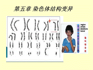 第五章染色体结构变异ppt课件.ppt