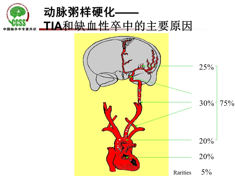 缺血性卒中的抗凝治疗ppt课件.ppt_第2页