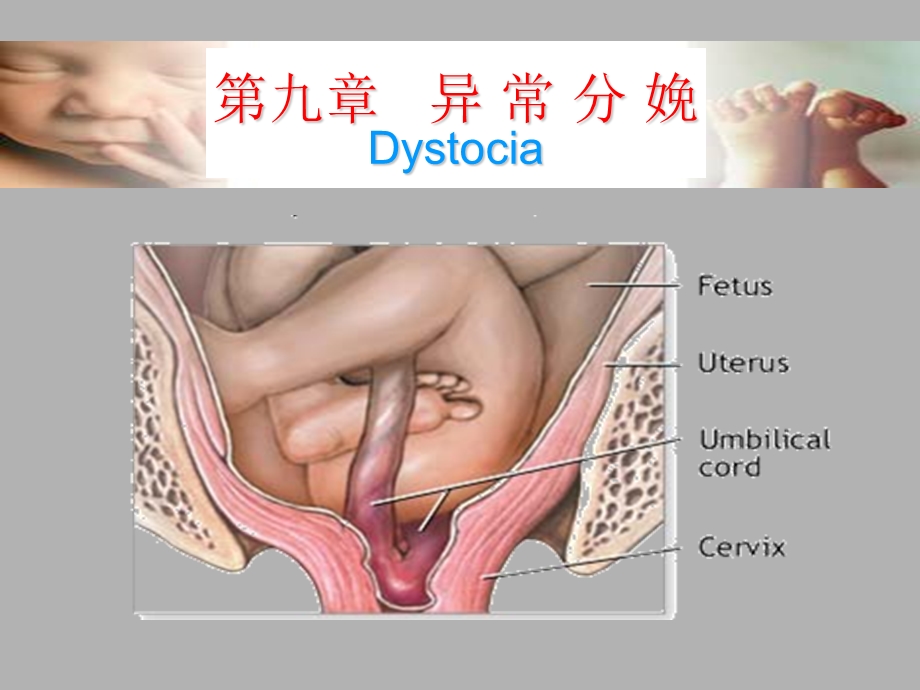 第九章异常分娩ppt课件.ppt_第1页