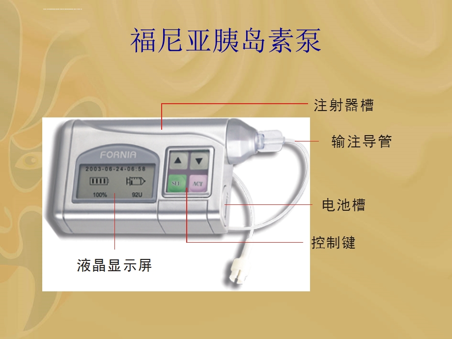 福尼亚胰岛素泵操作ppt课件.ppt_第2页