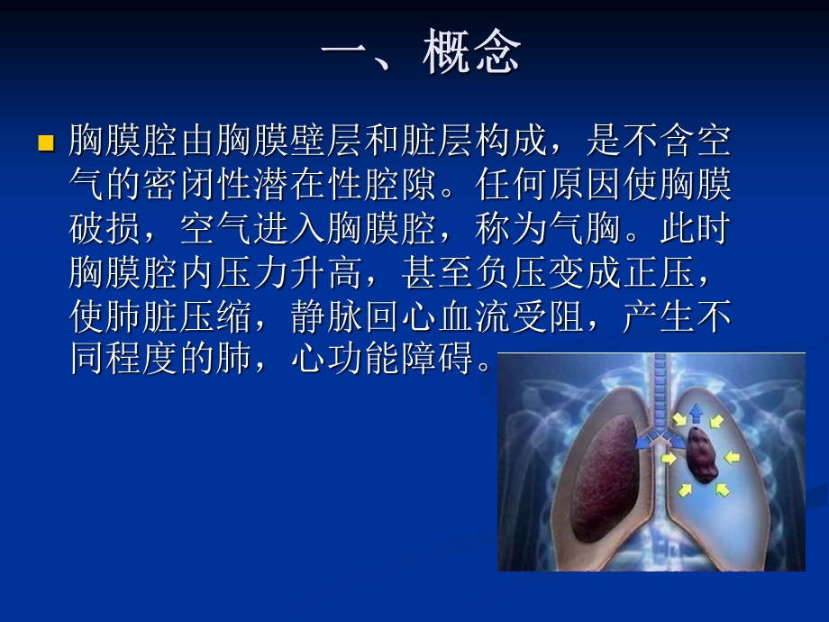 气胸患者的护理演示文稿ppt课件.ppt_第3页