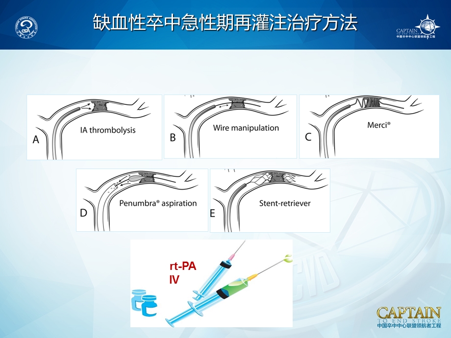 缺血性卒中急性期再灌注治疗ppt课件.ppt_第2页