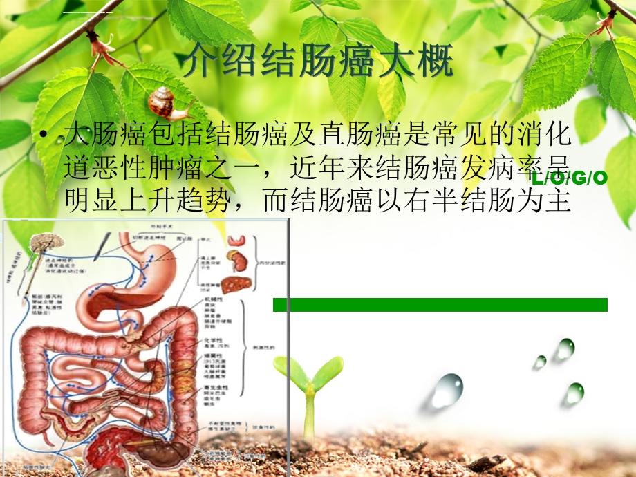 结肠癌教学查房ppt课件.ppt_第3页